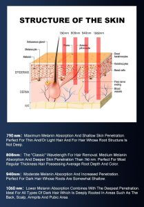 Vertical 4 Wavelength 755nm+808nm+940nm+1064nm Diode Laser Hair Removal Laser