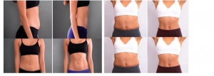 Vertical EMT Body Slimming Machine Building Muscle and Body Treatment