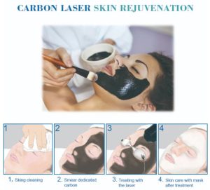 Pico laser tattoo removal machine