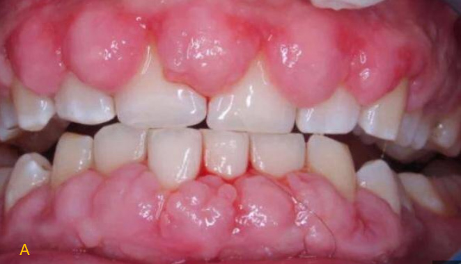 Dental Handpiece-6