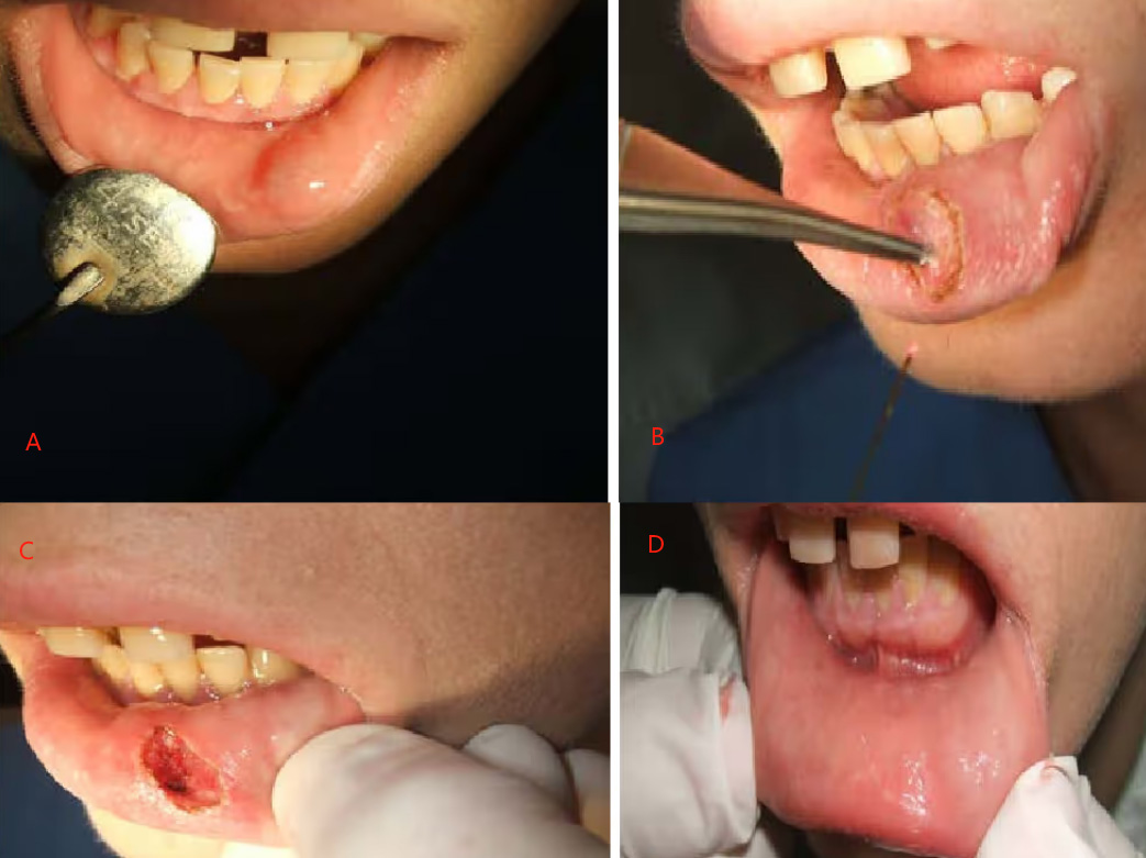 Dental Handpiece-8