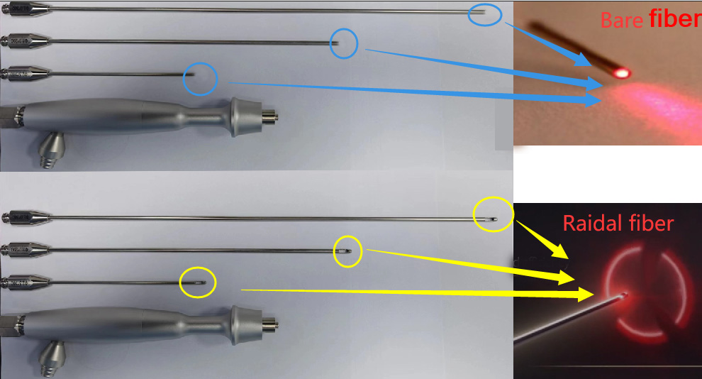 lipolysis liposuction 2 in 1-3