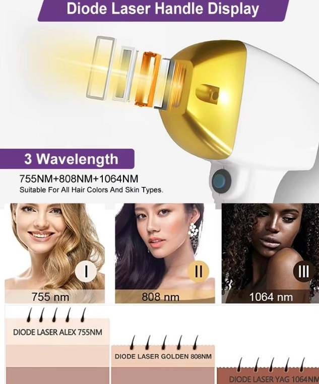 How Laser Hair Removal Works