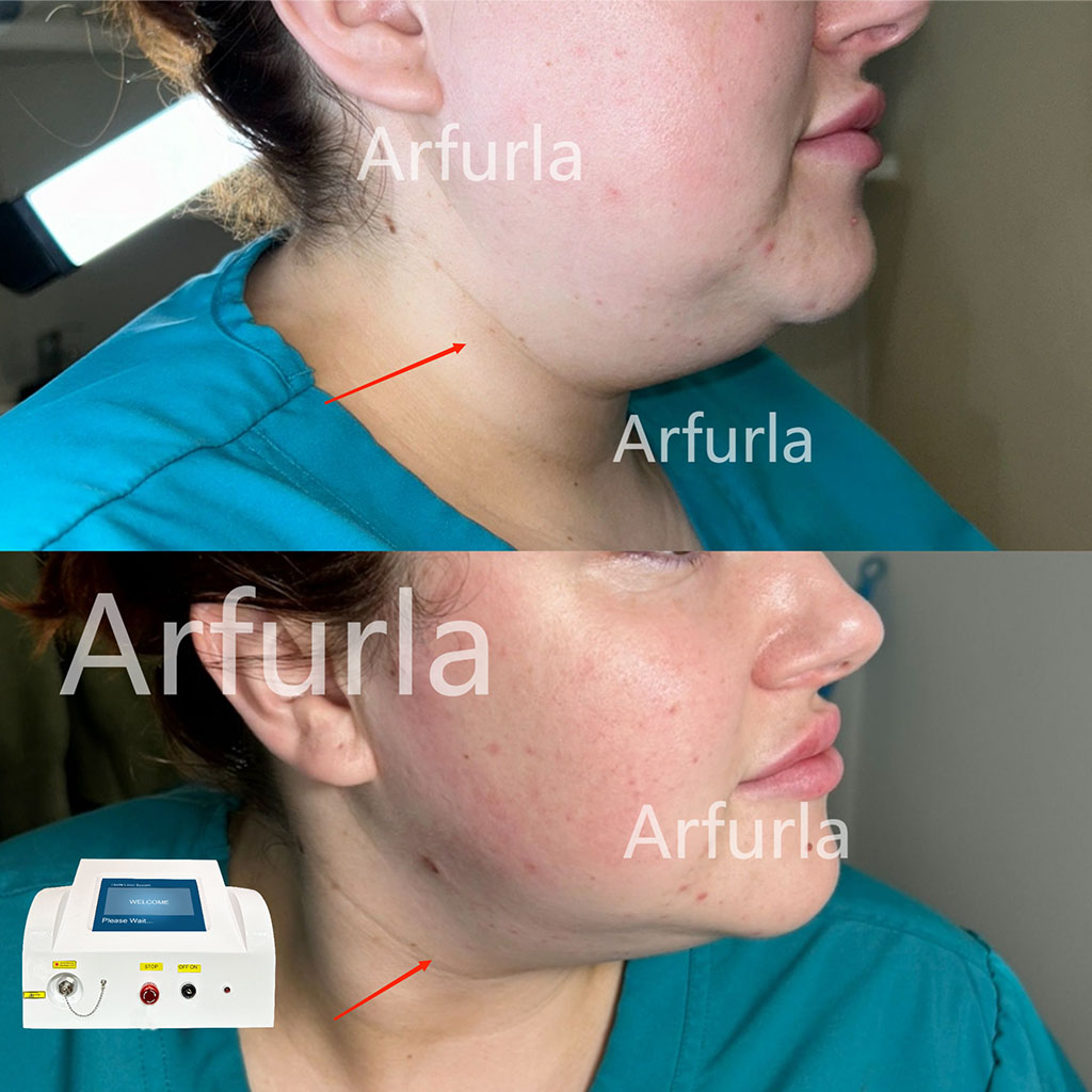 aftertrainingresluts