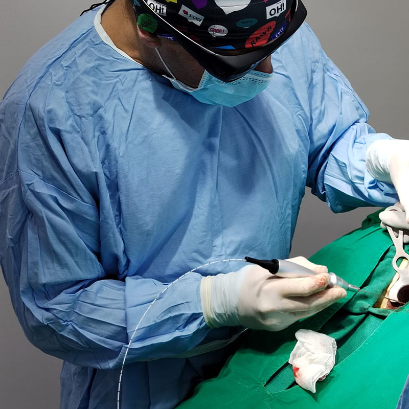 1470nm Diode laser Hemorrhoids Proctology Treatment