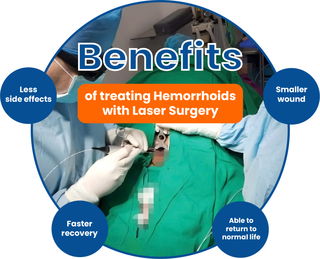 Advantage of Proctology Hemorrhoids Laser Treatment