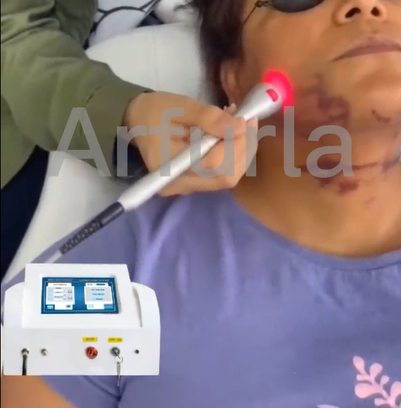 Indications Of Use Laser dental Dentistry Treatment Soft tissue procedures laser dentistry