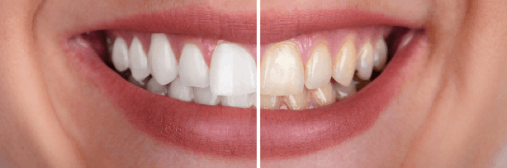 Peridontal procedures laser dentistry