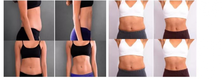 Body slimming machine7