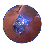 Fusion Plasma-4