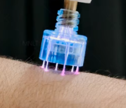 Fusion Plasma-5