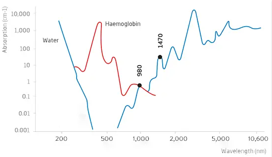 Comparison to Traditional Treatments