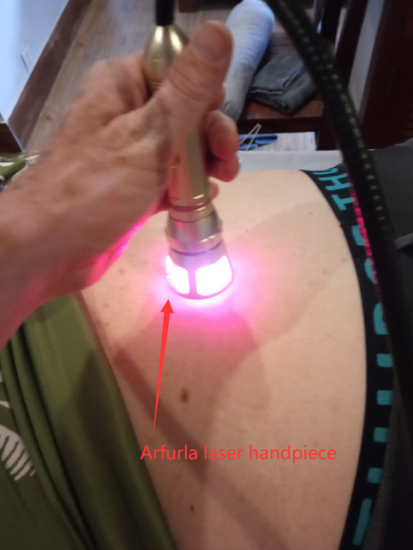 Clinical Advantages of Laser Therapy