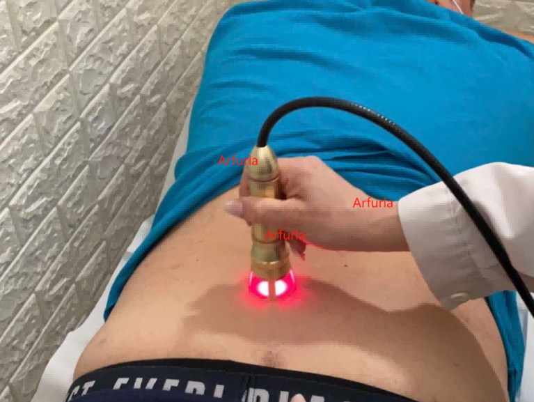Why Is Laser Power So Important?