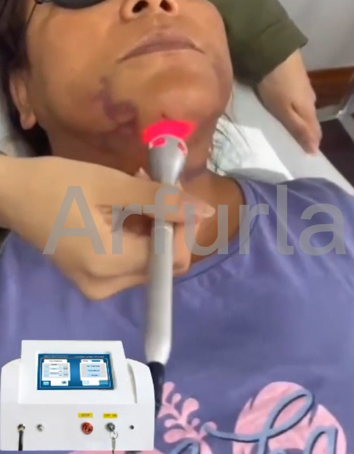 Dental Handpiece-12