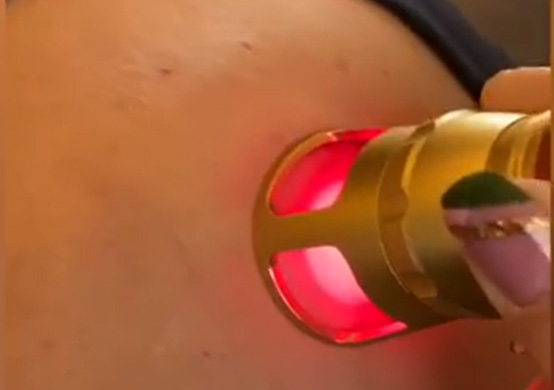 Physiotherapy Handle-5