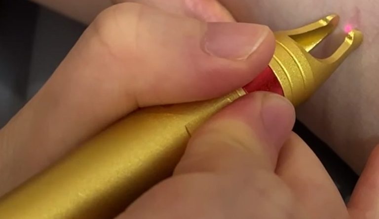 Vascular removal handle-3