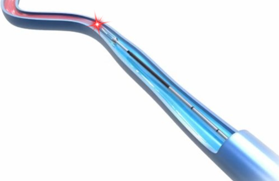 radial fiber-4