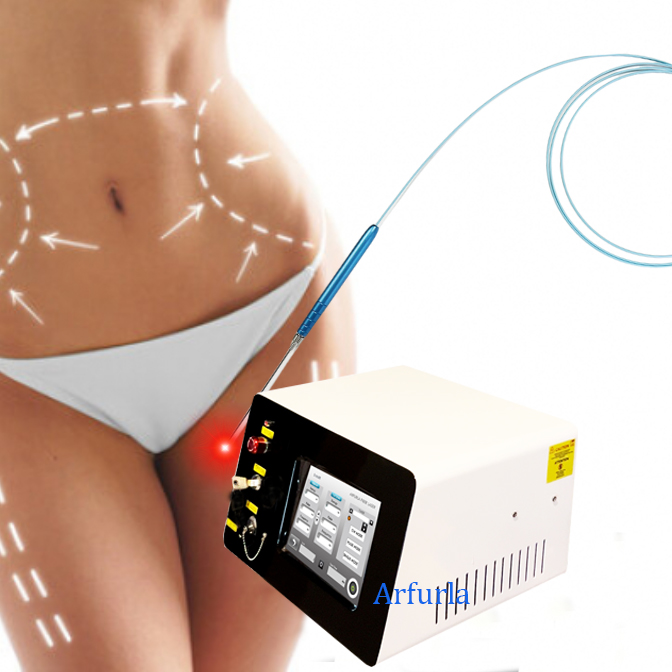 endoliftlaser