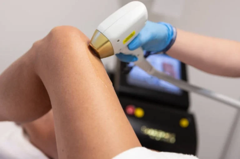 How Many Sessions for Diode Laser Hair Removal Machine What to Expect