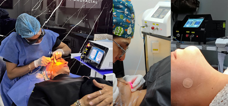 980nm and 1470nm Dual-Wavelength Diode Laser machine for Lipolysis manufacturer