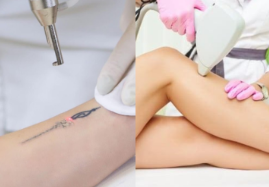 Arfurla’s Laser Hair Removal and Tattoo Removal Machine