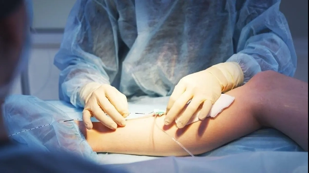 Dual Wavelength Surgical Laser for Endovenous (EVLT) Treatment