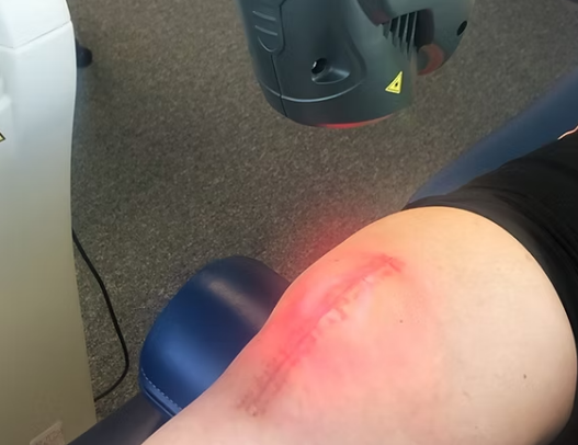 healingwhouldslaserthearpy