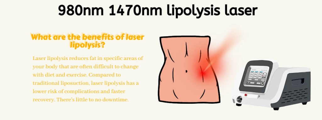 Arfurla Diode Laser 980nm 1470nm Bodylift Lipolysis Laser Treatment Laser machine manufacturer