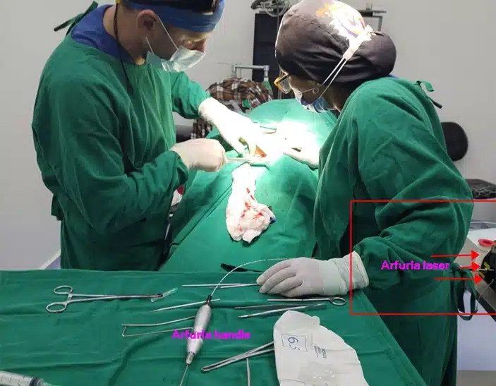 1470nm Diode Laser Treatment Hemorrhoids Proctology Surgery Proctology Laser