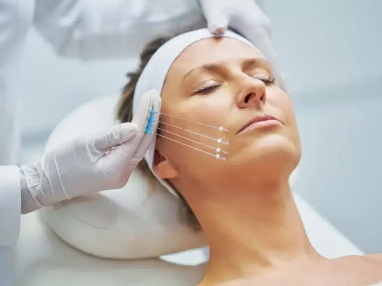 How Does an Endolift Treatment Work Its Wonders