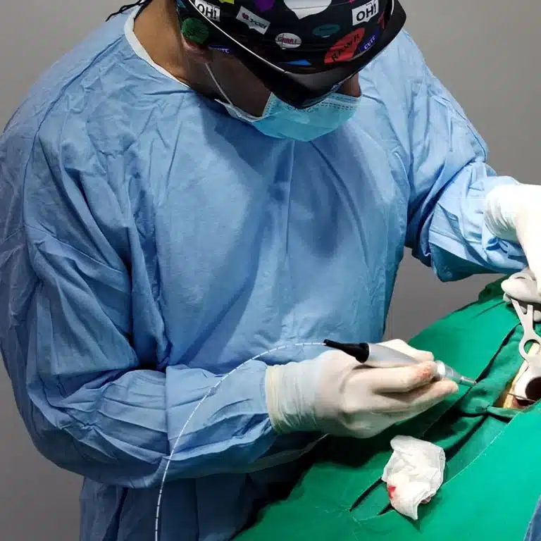 Proctology Laser Machines Benefits, Uses, and Where to Buy