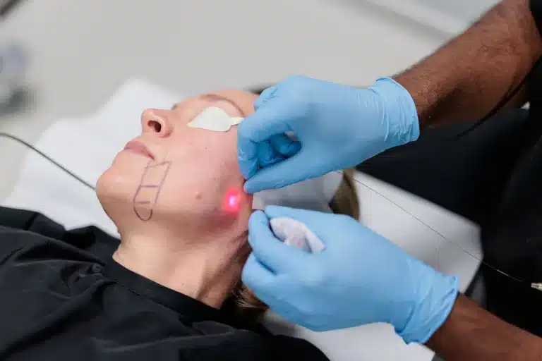 Long-Term Benefits of Endolift Sustaining Youthful Skin over Time