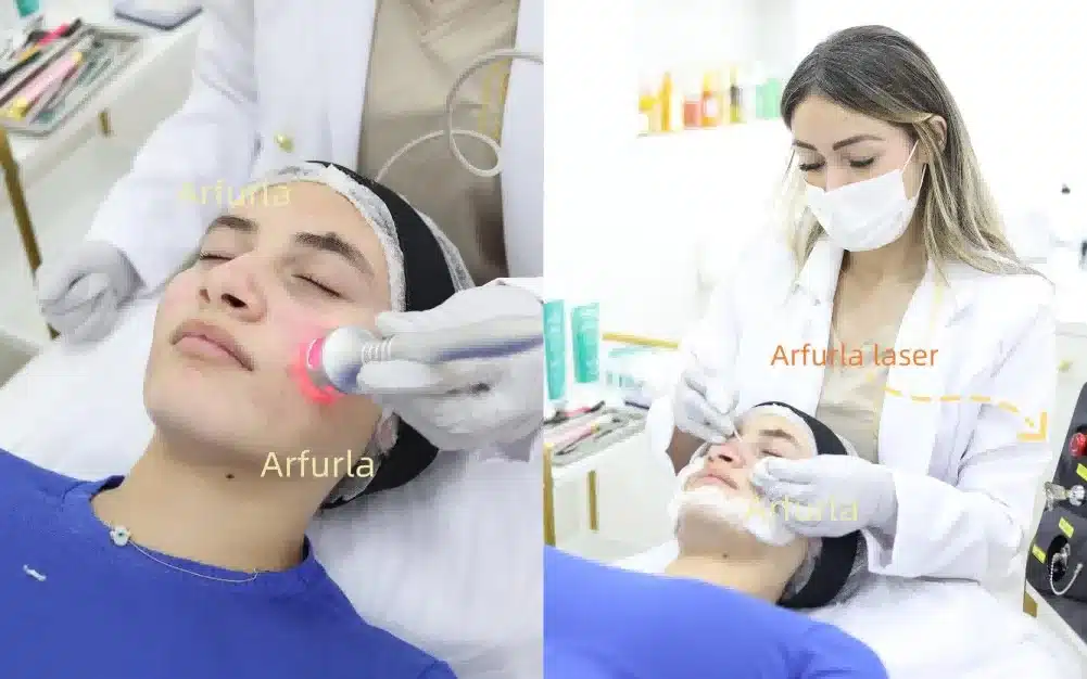 Arfurla Laser Clinical Skin Care Procedure