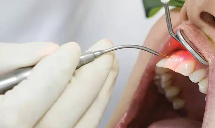 980nm-1470nm-diode-laser-for-dental-treatment