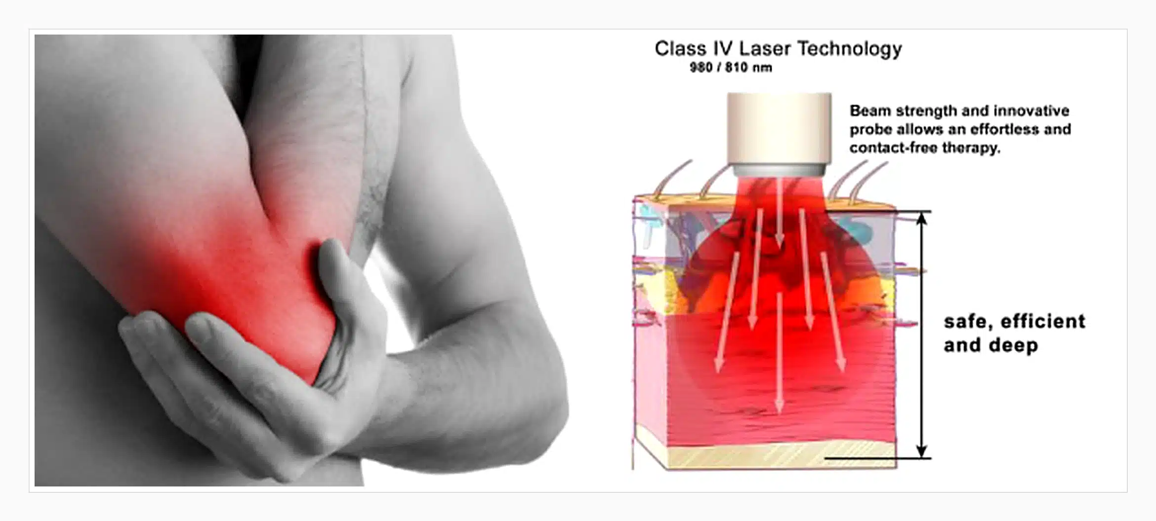 arfurla-class-iv-980-810nm-physiotherapy-laser-pain-relief